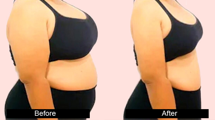 female breast reduction in jalandhar